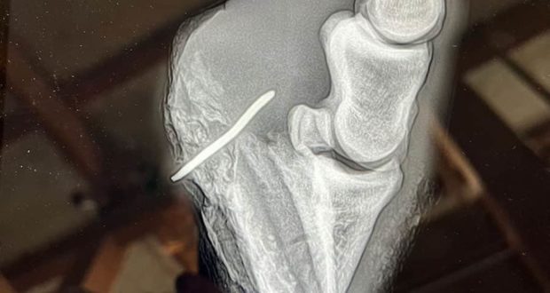 hoof puncture
