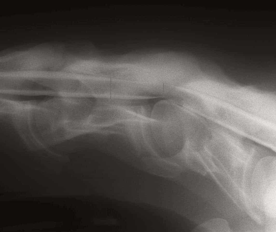Myelogram of Wobbler Horse