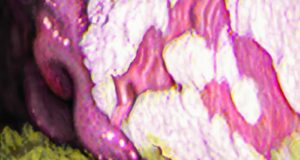 gastric ulcers
