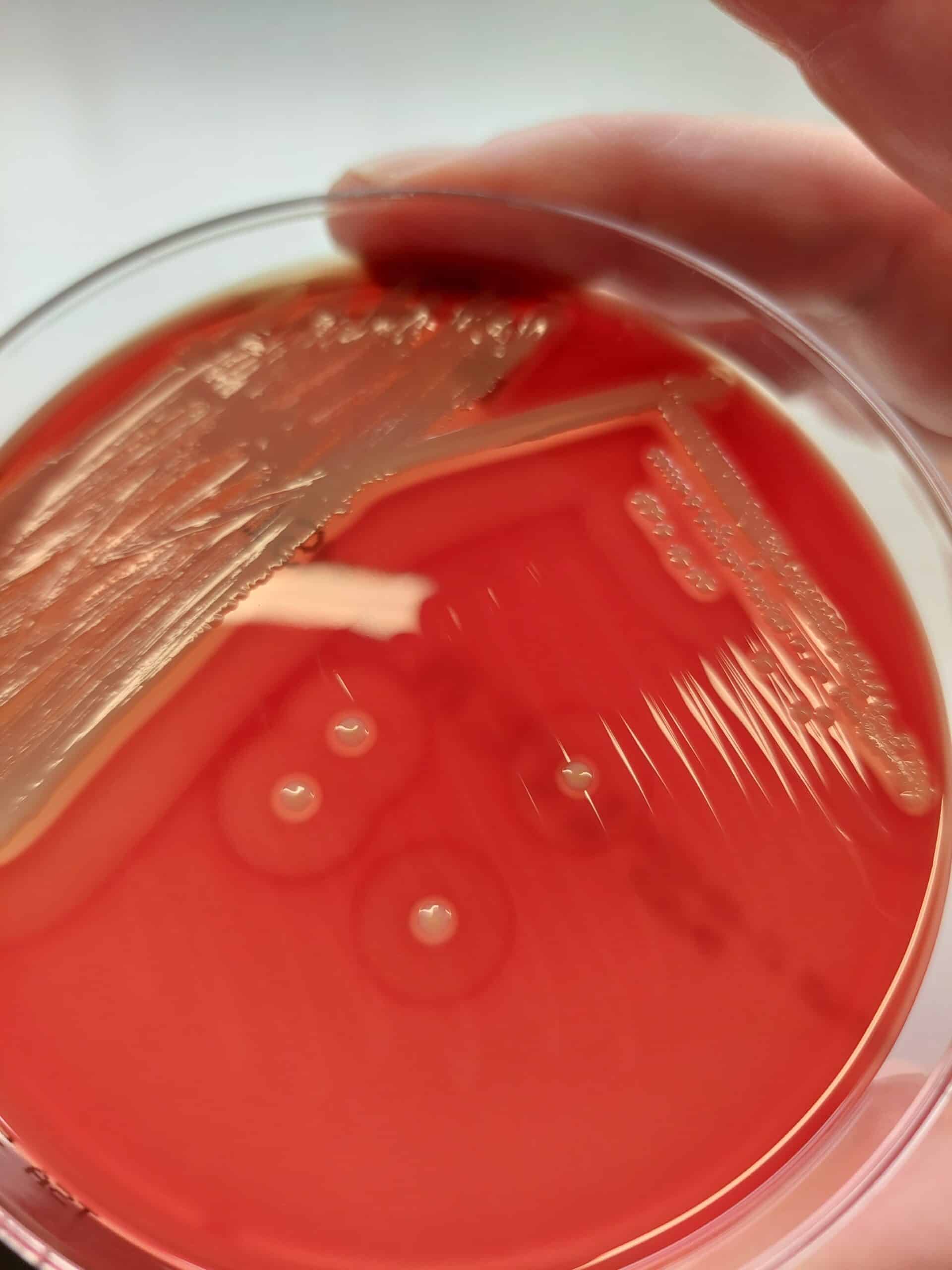 S. Aureus un facteur contributif dans la dermatite du paturon équin